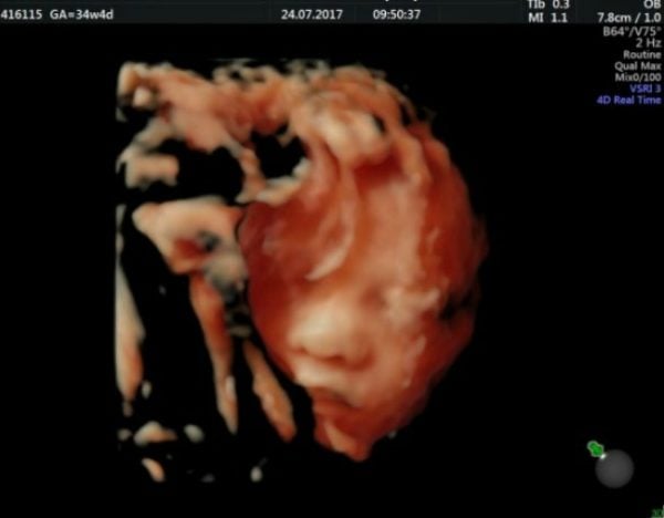 jennifer-lam-4d-scan