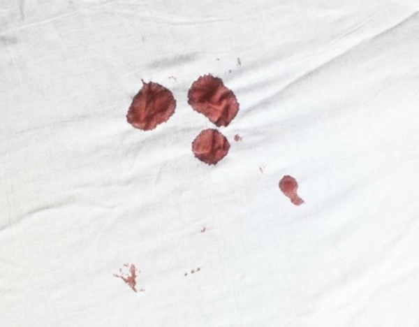Period blood clots, smell and colour. What your period is telling you.