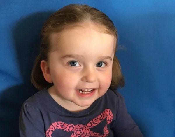spinal muscular atrophy