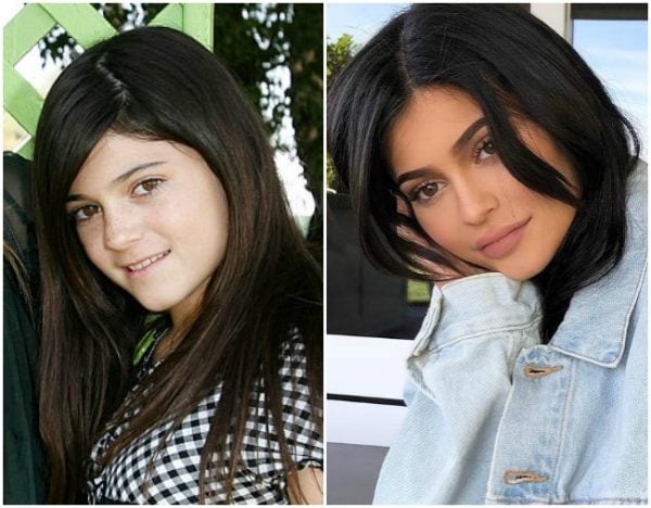 Kylie Jenner's transformation