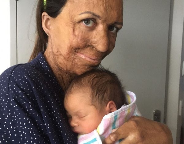 Turia Pitt and baby Hakavai