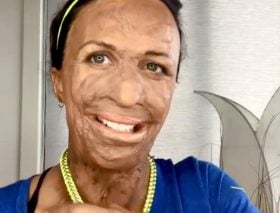 turia-pitt-necklace-trick