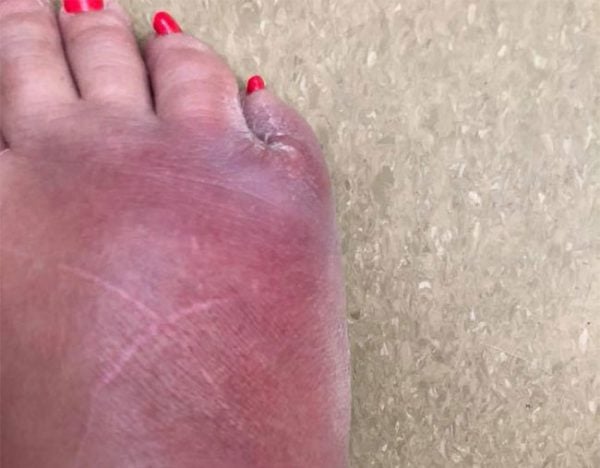 pedicure horror story