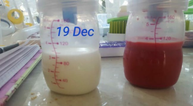 blood clot in breast milk