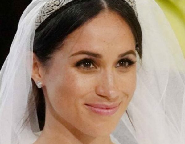 Meghan Markle freckles