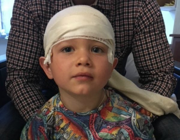my baby was born with a severe epileptic condition