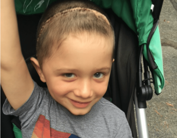 my baby was born with a severe epileptic condition