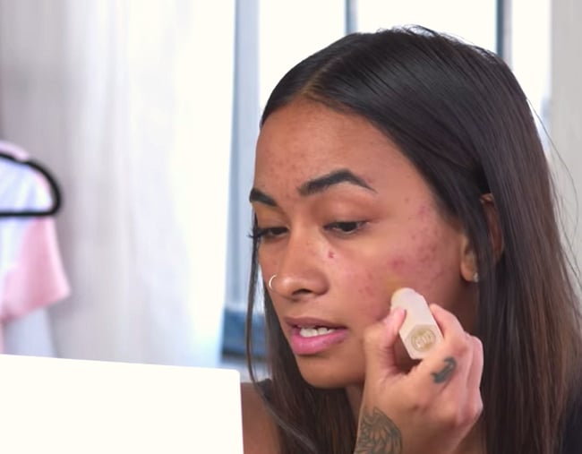 Fenty Beauty Released a Relatable Acne Coverage Tutorial Because