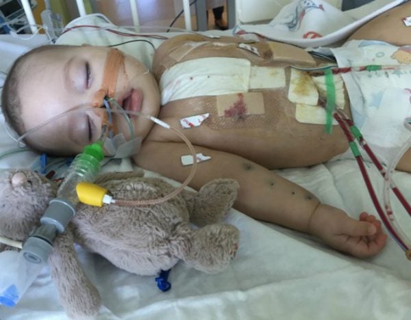 baby heart transplant