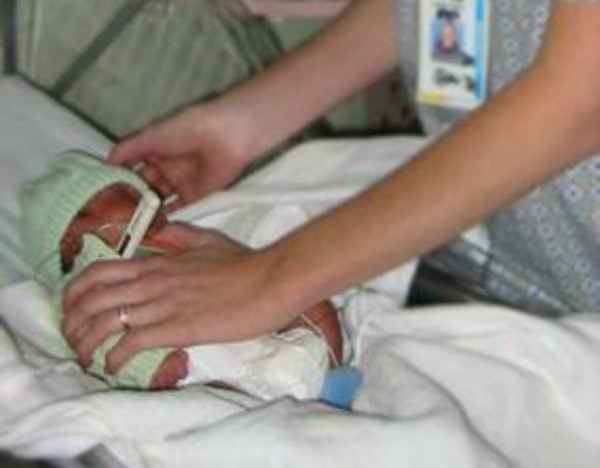 premature baby