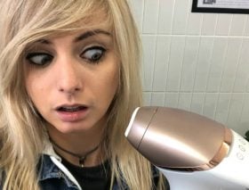 laser hair removal