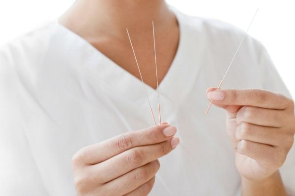 what-is-acupuncture