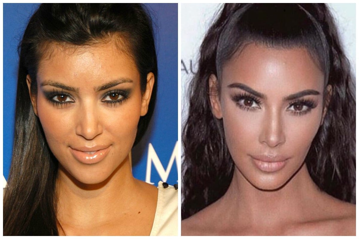 The Big Problem With Plastic Surgeons Dissecting Kim K S Plastic Surgery