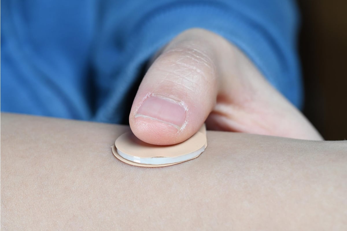microneedle patch contraception