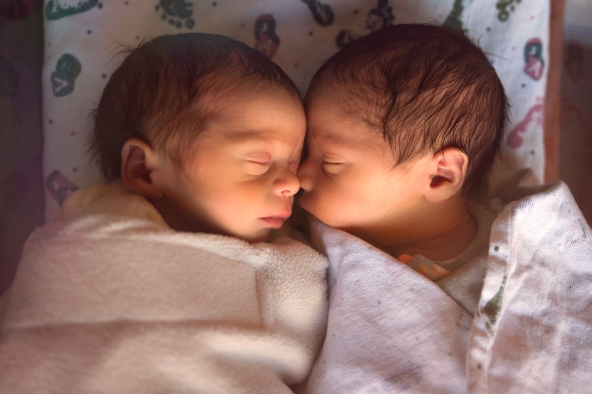 Non identical Identical Twins Science Has Discovered A Third Type Of Twin 