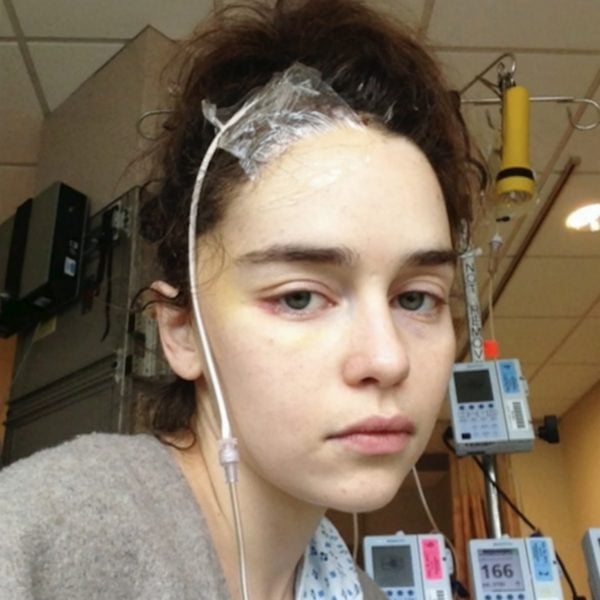 Emilia Clarke Without Makeup Telegraph