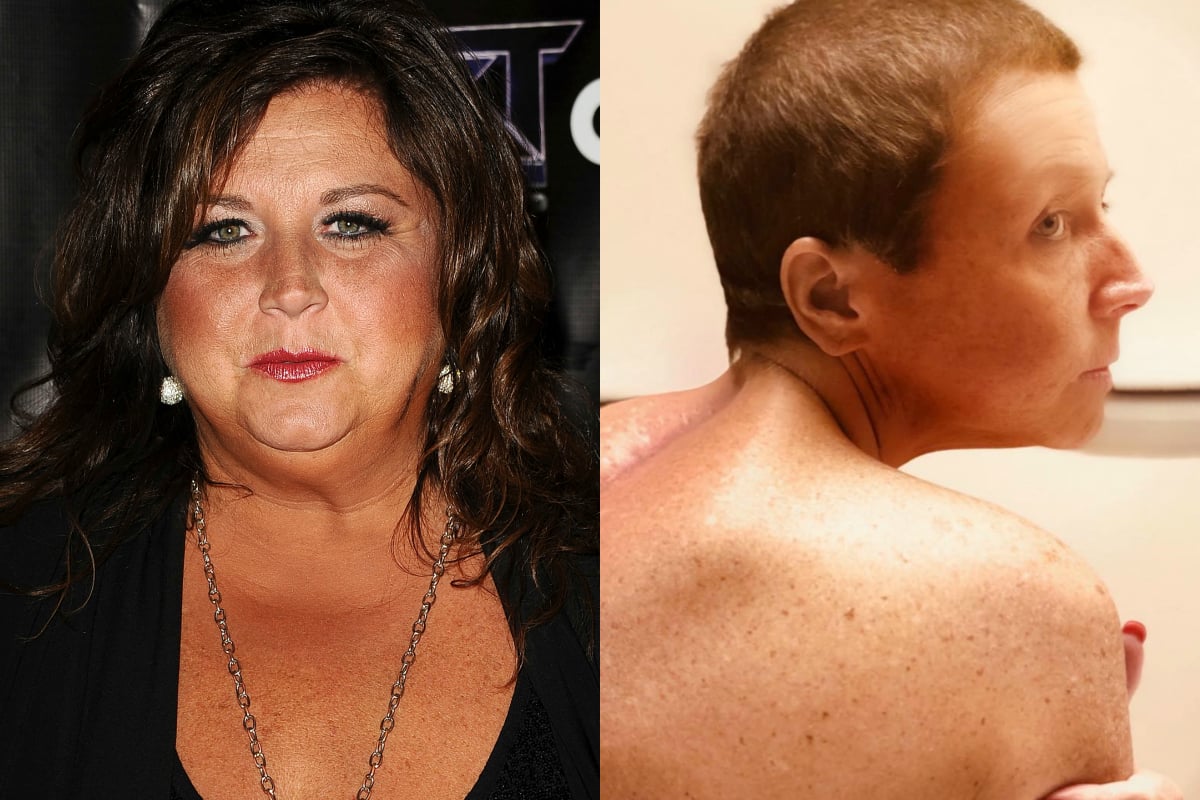 Nearly 5 Months After Her Emergency Spinal Surgery, Abby Lee