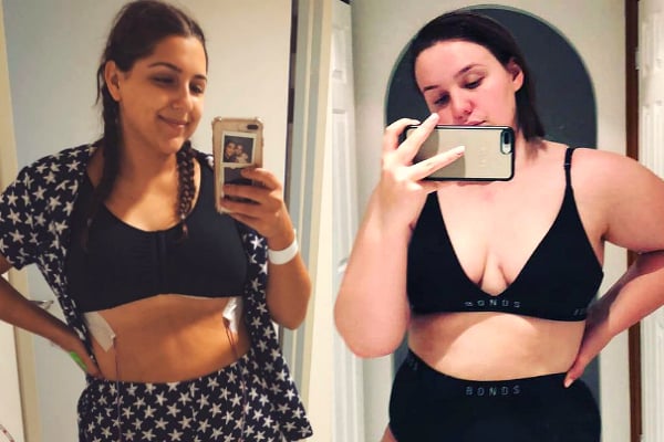 It has taken a massive toll on my body' - Mum with 40H bra size