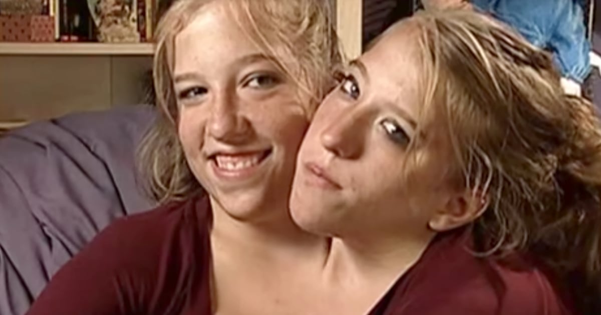 Inside The Life Of Conjoined Twins Abby And Brittany Hensel