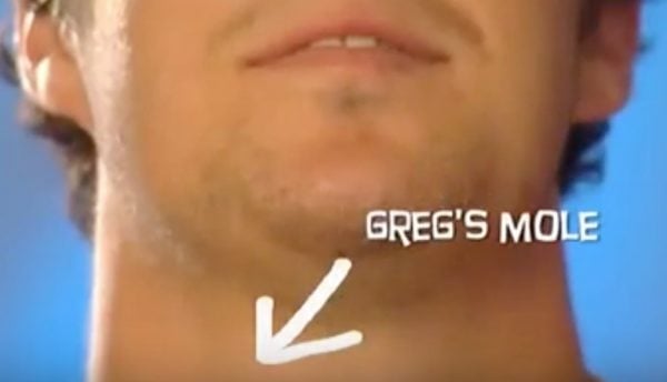 Greg's mole