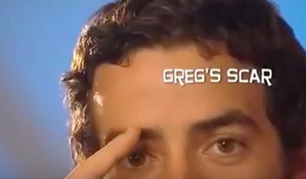 Greg's scar