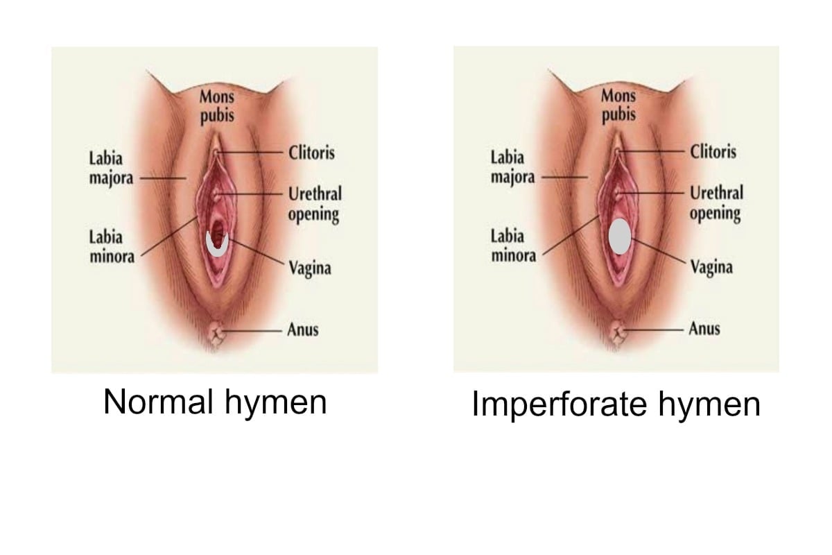 Vagina Before And After Virgin Intercourse