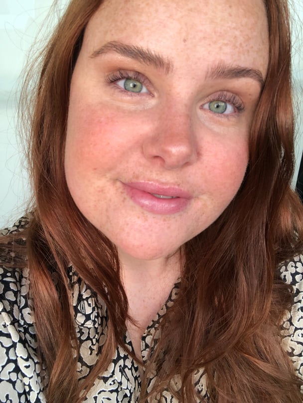 amy-clark-lymphatic-drainage-after
