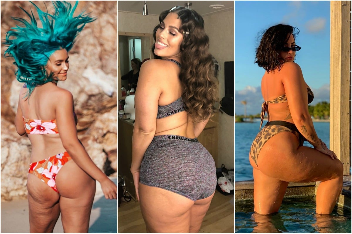 Celebs Celebrating Their Stretch Marks and Cellulite