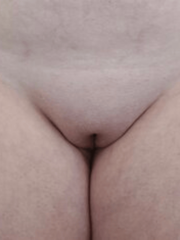 vulva