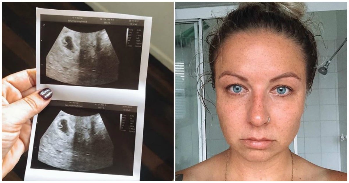 The uncensored reality of what a miscarriage looks like.