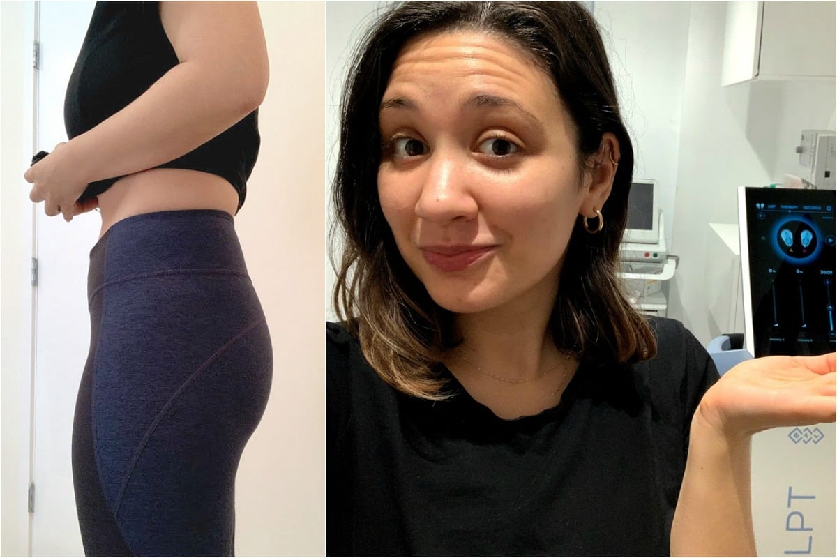 Emsculpt review: 'I tried the non-surgical butt lift to see if it